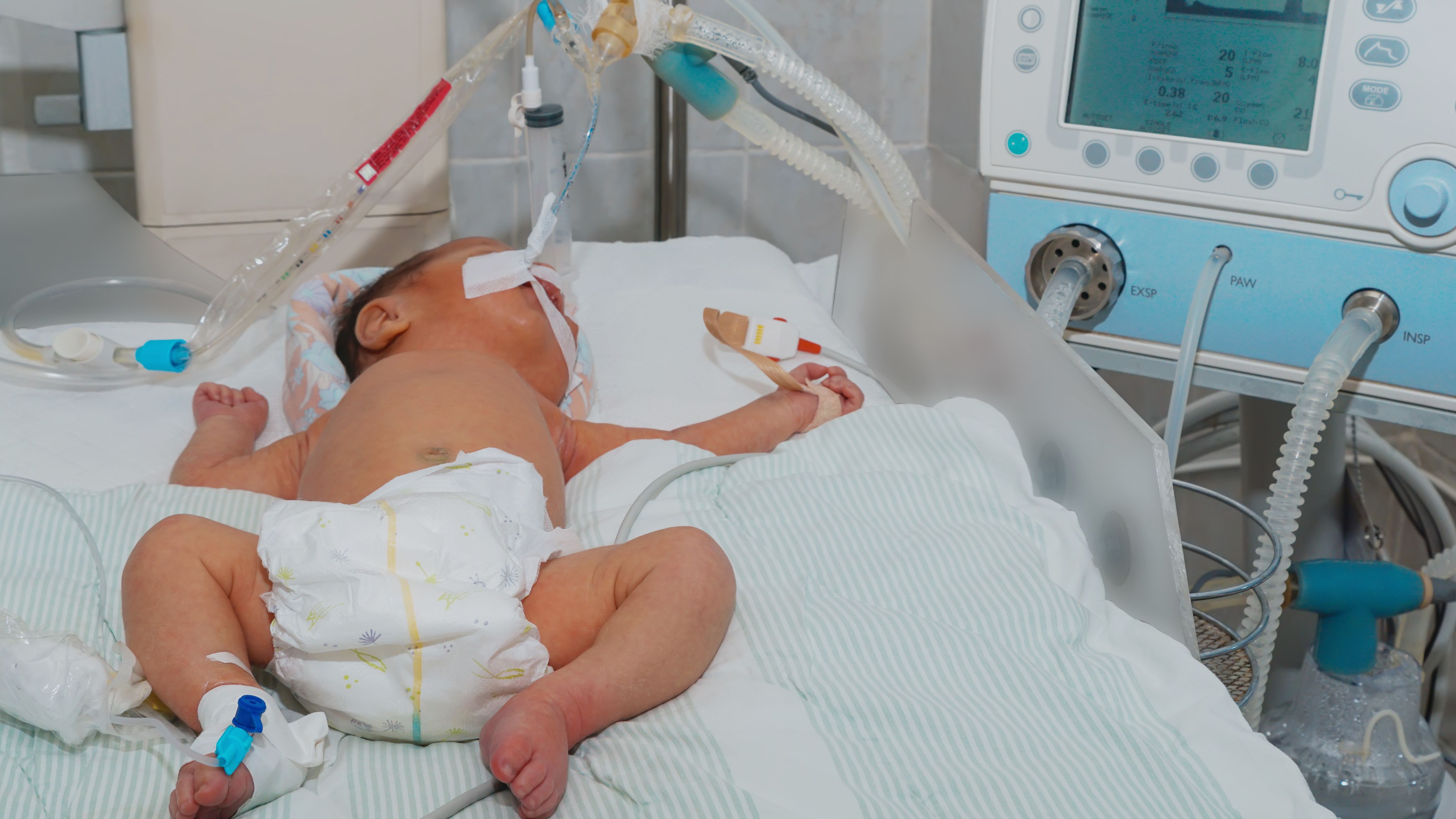 neonatal respiratory applications