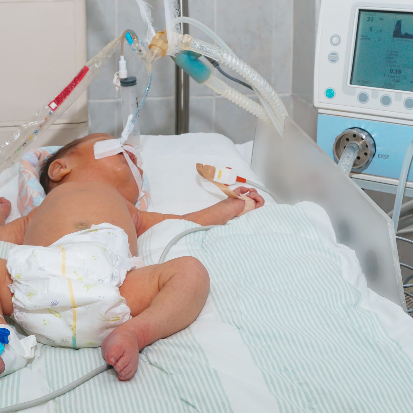 Smart-NeonaTO Project